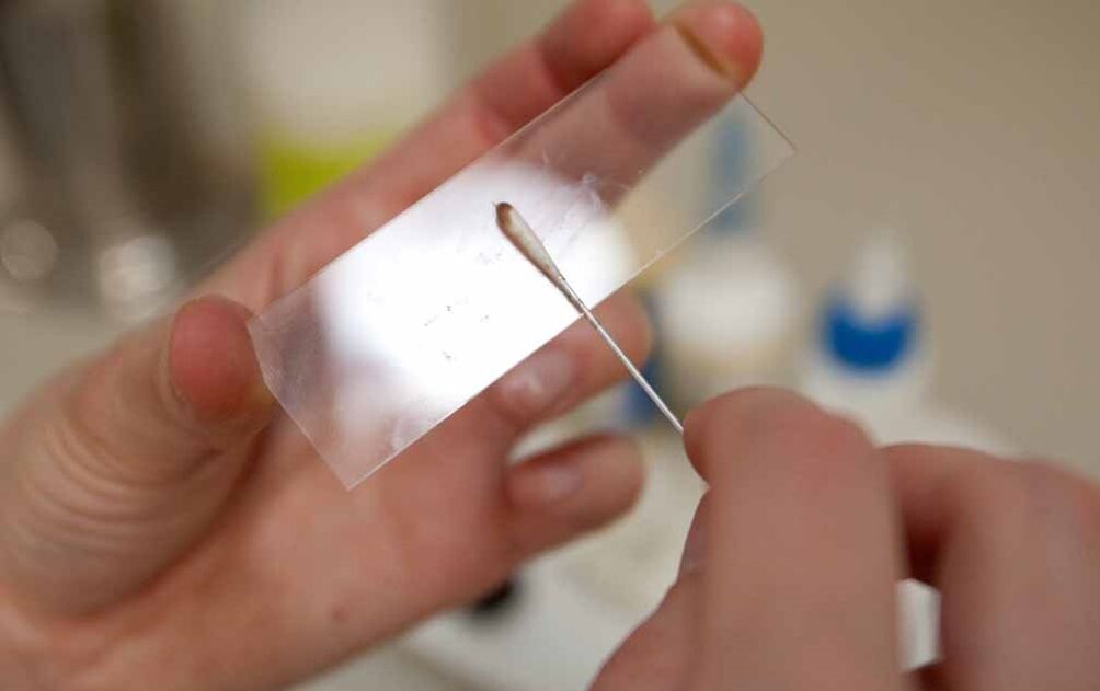scraping to detect the presence of parasites in the body