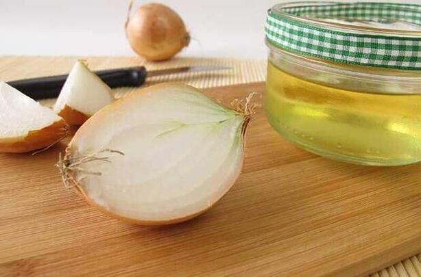 Onion infusion for removing worms, used for a week