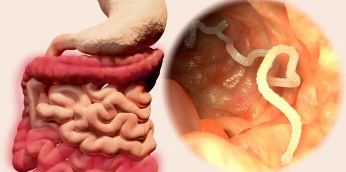 worm is a parasite in humans